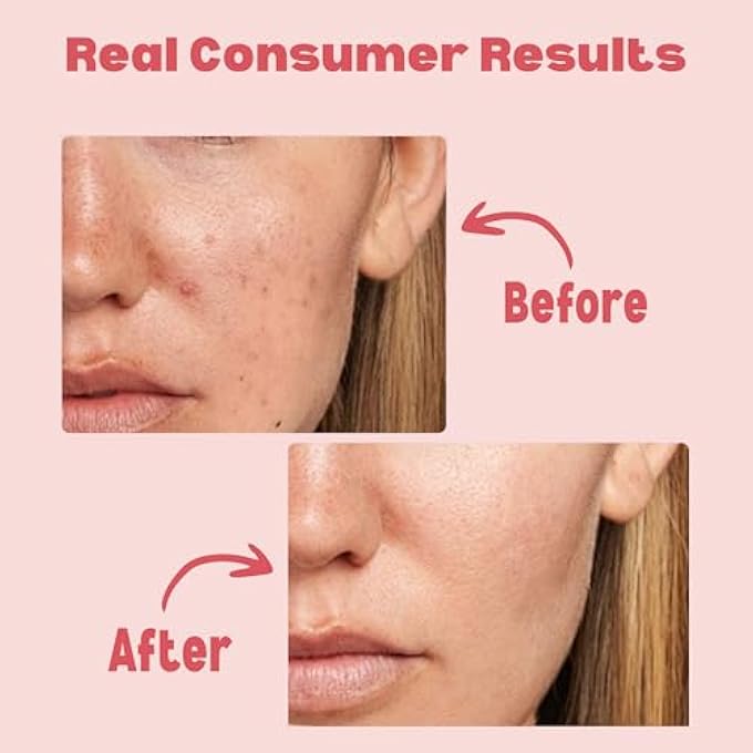 CNMOFAXIN VITAMIN C FACIAL CLEANSER  BRIGHTENING FACE WASH WITH VITAMIN C, NIACINAMIDE, & CENTELLA EXTRACT  REDUCES DARK SPOTS & WRINKLES  GENTLY CLEANSES & REMOVES EXCESS OIL (480ML) - Image 3